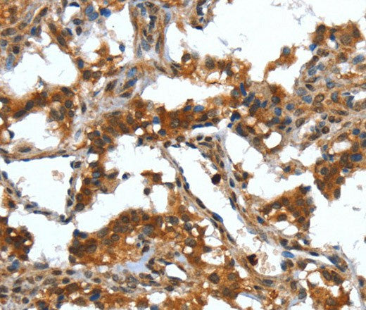 DEFA4 Polyclonal Antibody – Figure 1 of 3