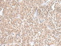 THAP12 Polyclonal Antibody – Figure 1 of 2