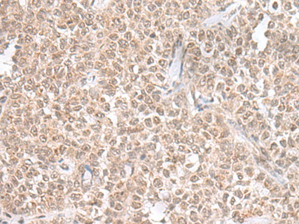 THAP12 Polyclonal Antibody – Figure 1 of 2