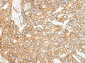 NME4 Polyclonal Antibody – Figure 1 of 3