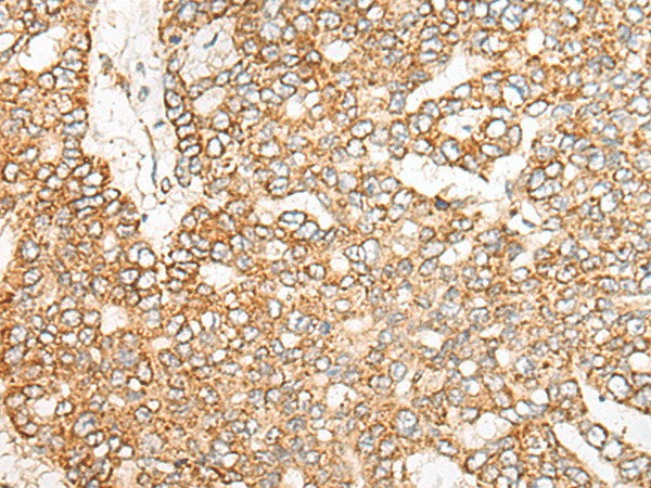 NME4 Polyclonal Antibody – Figure 1 of 3