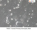 Human Primary Astrocytes, fetal | Applied Biological Materials (abm)