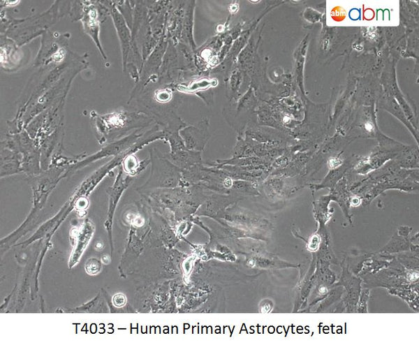 Human Primary Astrocytes, fetal | Applied Biological Materials (abm)