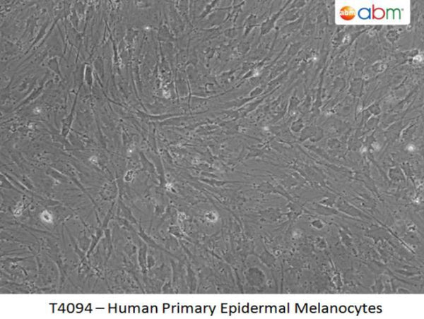 Human Primary Epidermal Melanocytes | Applied Biological Materials (abm)
