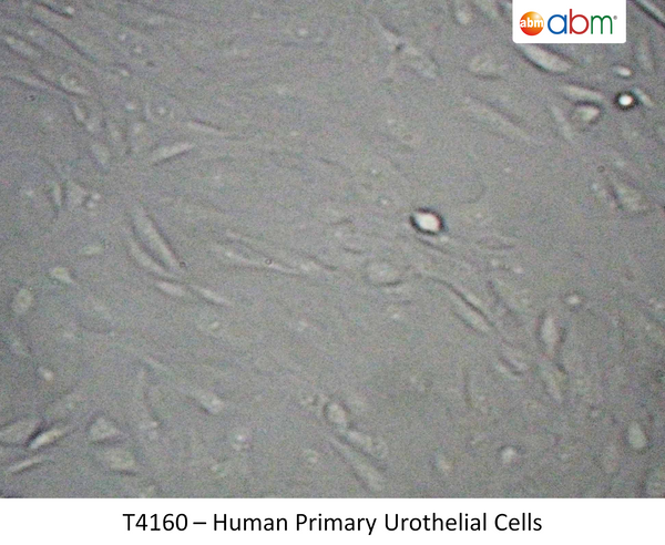 Human Primary Urothelial Cells | Applied Biological Materials (abm)
