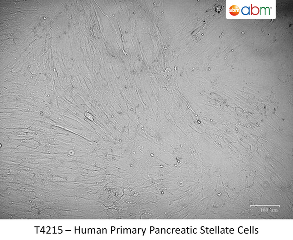 Human Primary Pancreatic Stellate Cells | Applied Biological Materials (abm)