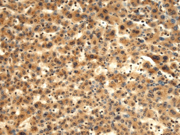 TMOD1 Polyclonal Antibody – Figure 1 of 2