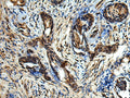TBCC Polyclonal Antibody – Figure 1 of 2