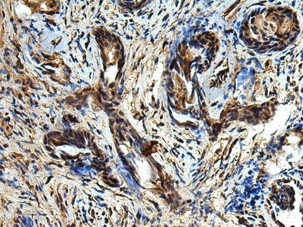 TBCC Polyclonal Antibody – Figure 1 of 2