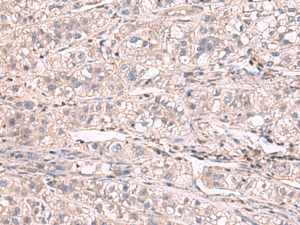 KCNIP1 Polyclonal Antibody – Figure 1 of 3