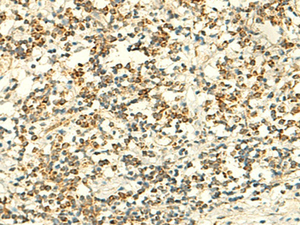 IFT27 Polyclonal Antibody – Figure 1 of 3