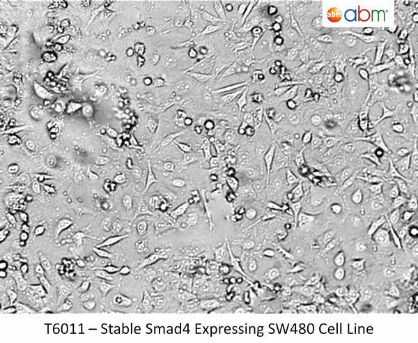 Stable Smad4 Expressing SW480 Cell Line | Applied Biological Materials (abm)