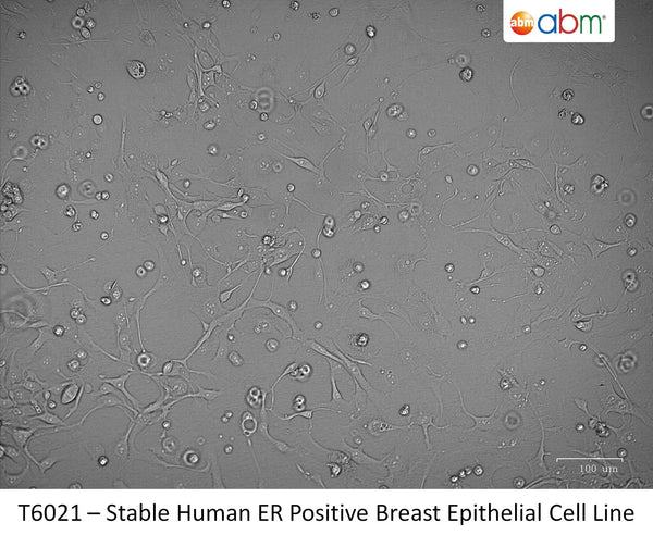 Stable Human ER Positive Breast Epithelial Cell Line | Applied Biological Materials (abm)