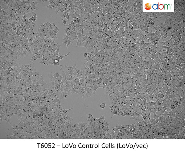 LoVo Control Cells (LoVo/vec) | Applied Biological Materials (abm)