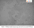 TIP49wt Stable Expressing LoVo Cell Line (LoVo/TIP49wt) | Applied Biological Materials (abm)