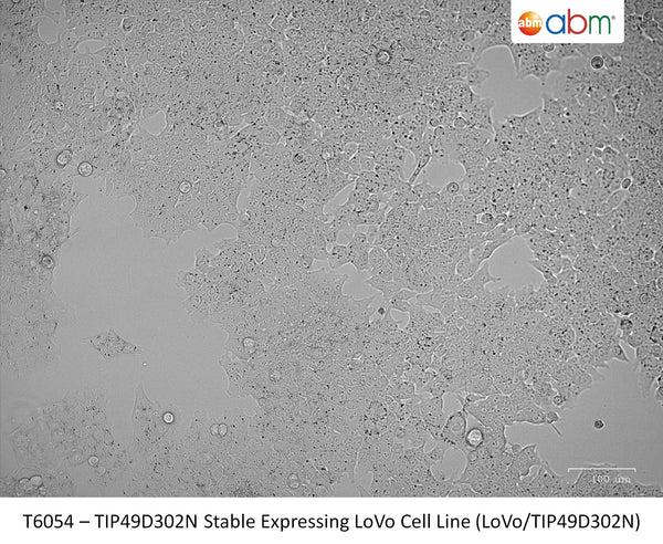 TIP49D302N Stable Expressing LoVo Cell Line (LoVo/TIP49D302N) | Applied Biological Materials (abm)