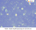 Stable Hep3B Expressing miR-122 Cell Line | Applied Biological Materials (abm)