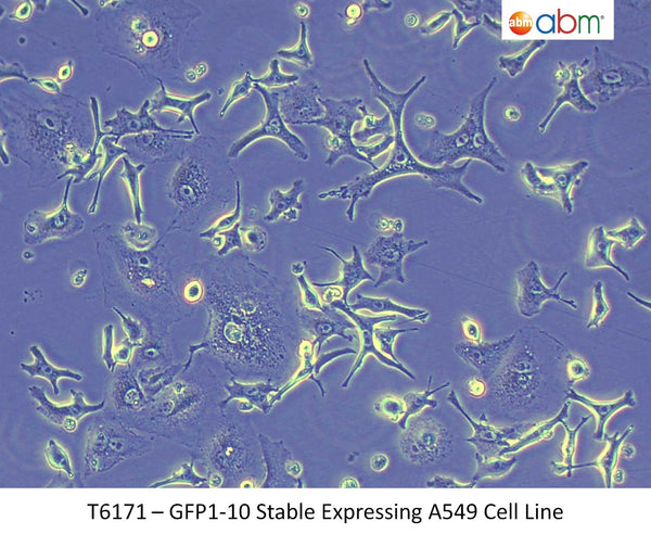 GFP1-10 Stable Expressing A549 Cell Line | Applied Biological Materials (abm)