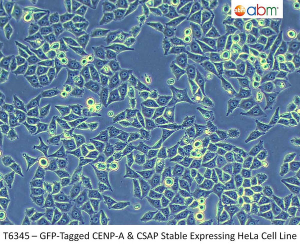 GFP-Tagged CENP-A & CSAP Stable Expressing HeLa Cell Line | Applied Biological Materials (abm)