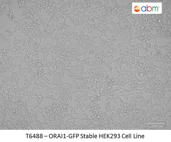 ORAI1-GFP Stable HEK293 Cell Line | Applied Biological Materials (abm)