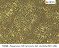 Squamous Cell Carcinoma Cell Line (UM-SCC-123) | Applied Biological Materials (abm)