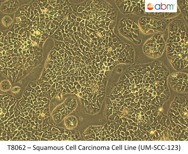 Squamous Cell Carcinoma Cell Line (UM-SCC-123) | Applied Biological Materials (abm)
