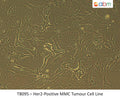 Her2-Positive MMC Tumour Cell Line | Applied Biological Materials (abm)