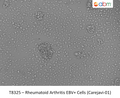 Rheumatoid Arthritis EBV+ Cells (Carejavi-01) | Applied Biological Materials (abm)