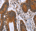 IHH Polyclonal Antibody – Figure 1 of 3