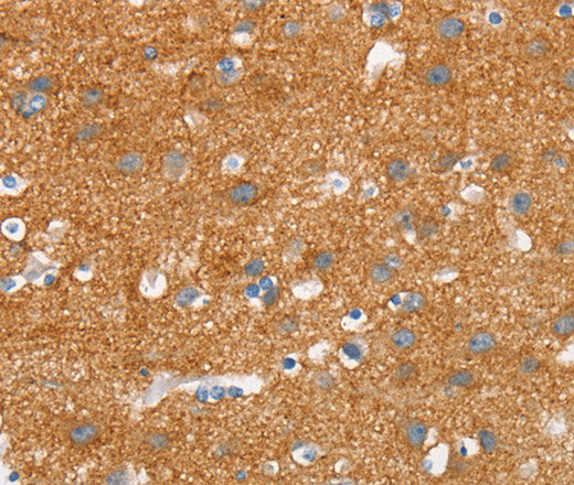 SNCA Polyclonal Antibody – Figure 1 of 3