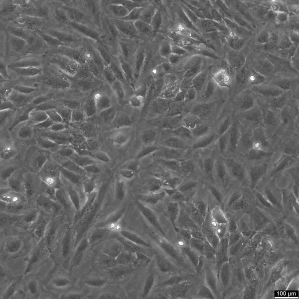 TCCSUP cell