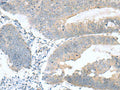 KRCC1 Polyclonal Antibody – Figure 1 of 3