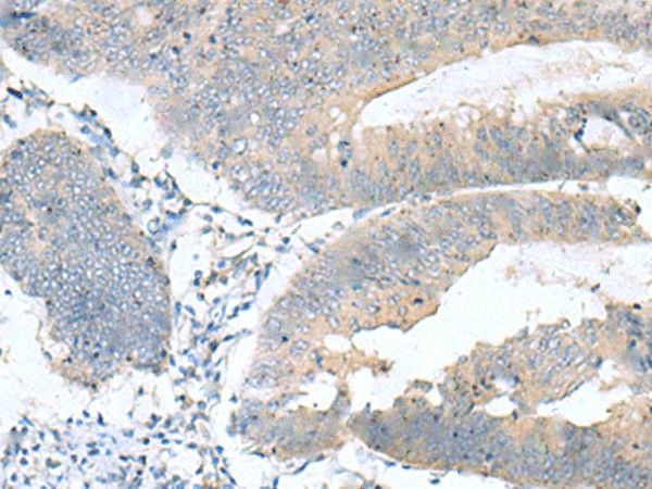 KRCC1 Polyclonal Antibody – Figure 1 of 3