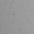 TE-1 cell