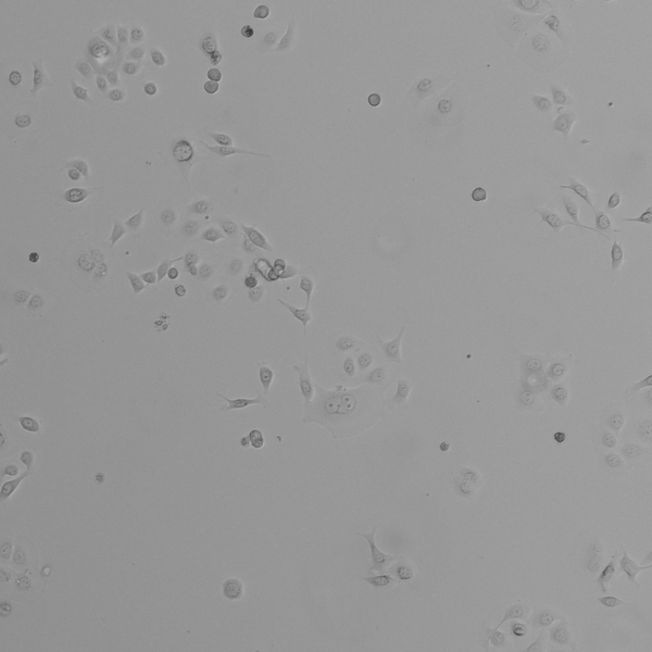 TE-1 cell