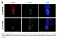 ABI3 CRISPR Knockout 293T Cell Line | Applied Biological Materials (abm)