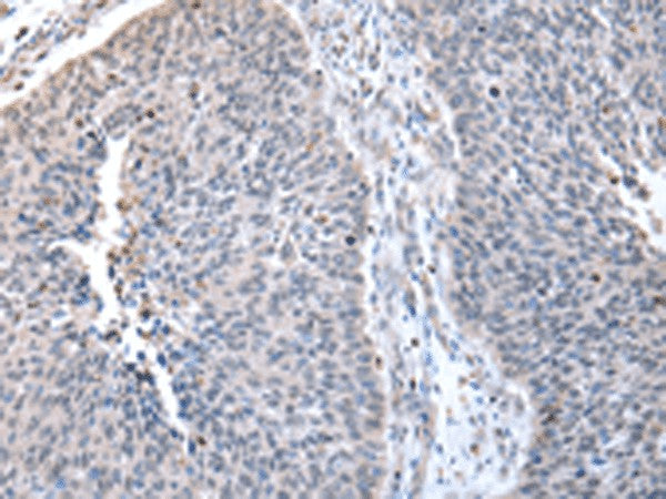 ZNF23 Polyclonal Antibody – Figure 1 of 2