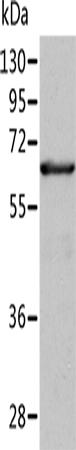 ALDH4A1 Polyclonal Antibody – Figure 1 of 4