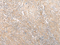 EPS15 Polyclonal Antibody – Figure 1 of 3