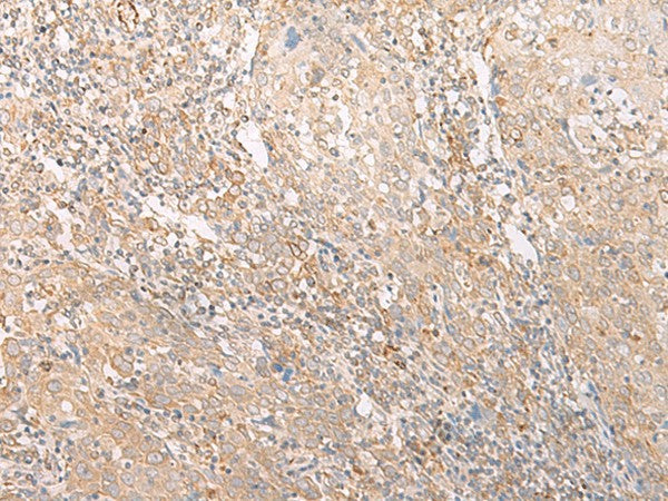 EPS15 Polyclonal Antibody – Figure 1 of 3