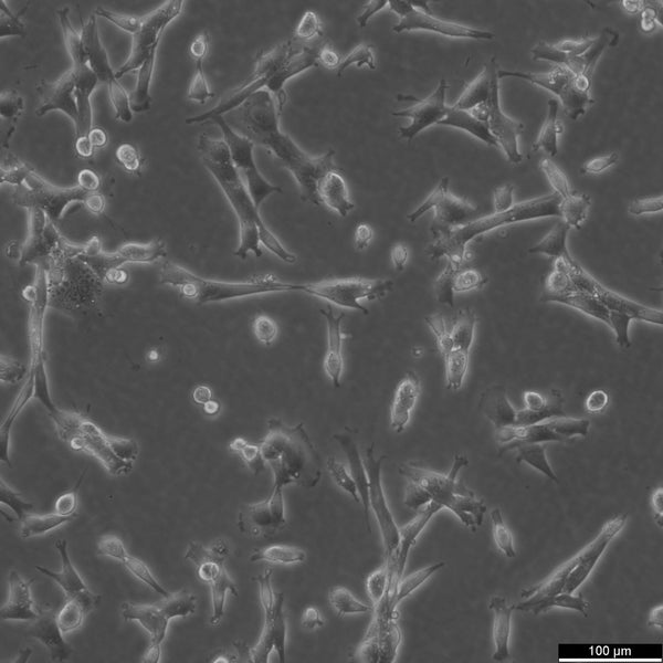 TM4 cell