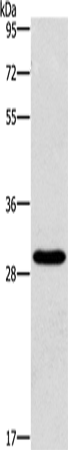 BCL10 Polyclonal Antibody – Figure 1 of 4