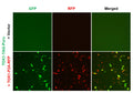 TOX1 Reporter Lentivirus – Figure 1