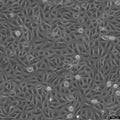 TPC-1 cell