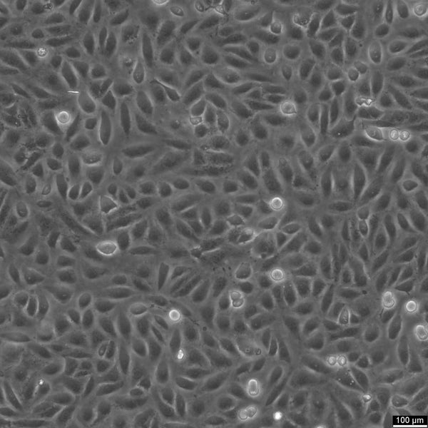 TPC-1 cell