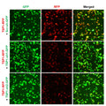 h/m TSP1 shRNA Lentivirus – Figure 1