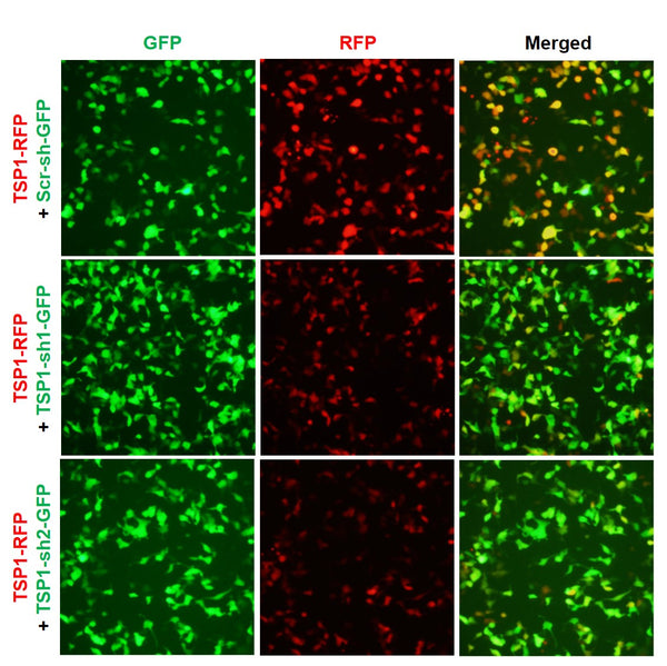 h/m TSP1 shRNA Lentivirus – Figure 1