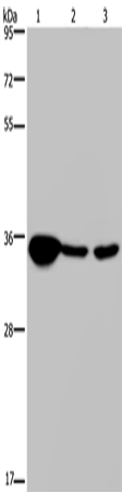 LZTFL1 Polyclonal Antibody – Figure 1 of 4