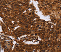FANCF Polyclonal Antibody – Figure 1 of 3