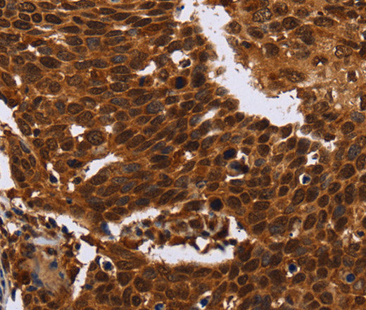 FANCF Polyclonal Antibody – Figure 1 of 3